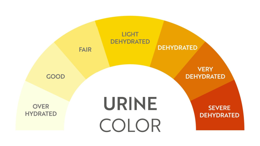 warna air kencing normal