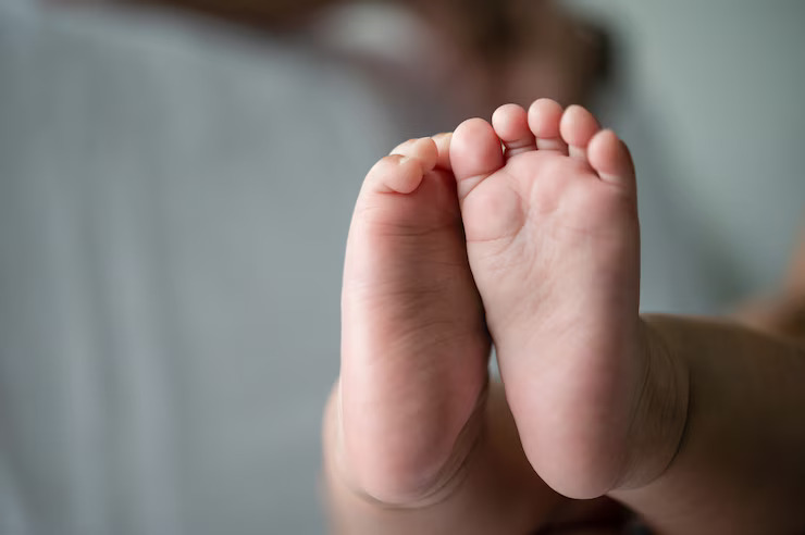 kaki pengkor clubfoot