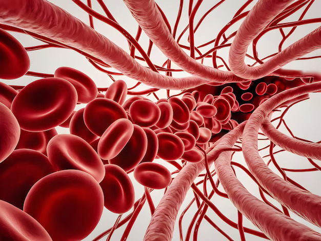 Arteritis