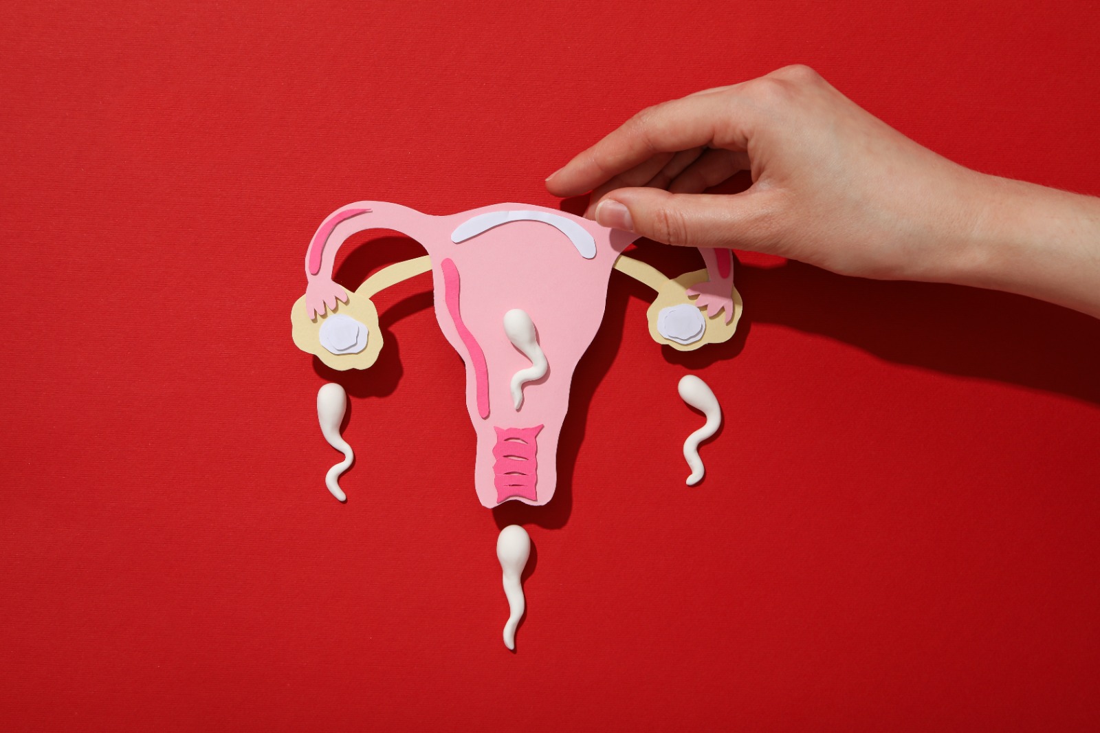 endometriosis